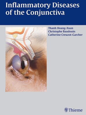 cover image of Inflammatory Diseases of the Conjuctiva